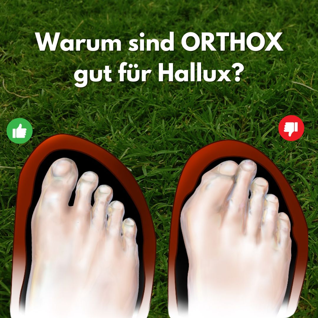 OrthoX Hallux – ergonomische & schmerzlindernde Hallux Valgus Schuhe